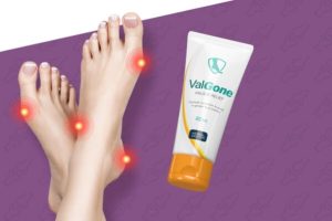 Valgone iskustva | Rješenje problema hallux valgusa?